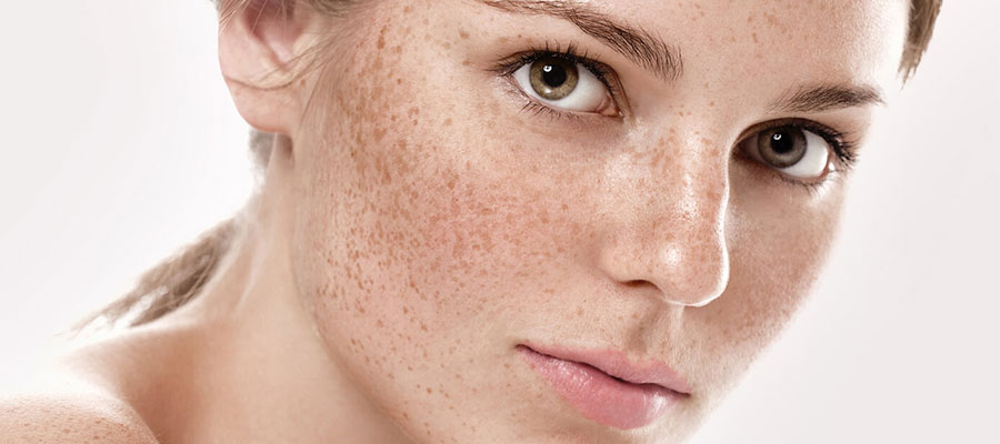 Mela Bakımı ( Leke Protokolü )